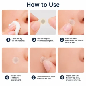 🎉🎉𝐇𝐢𝐬𝐤𝐢𝐧® 2-in-1 Microneedle & Hydrocolloid Patch | Removes raised moles, acne, flat warts, and skin tags | Helps improve wrinkles, scars, and blemishes | Invisible patches for face and body