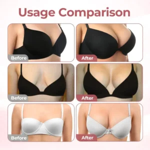 HISKIN® BREAST ENHANCEMENT  LIFT & FIRM MICRONEEDLE PATCHES