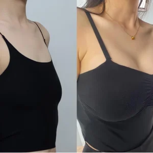 HISKIN® BREAST ENHANCEMENT  LIFT & FIRM MICRONEEDLE PATCHES