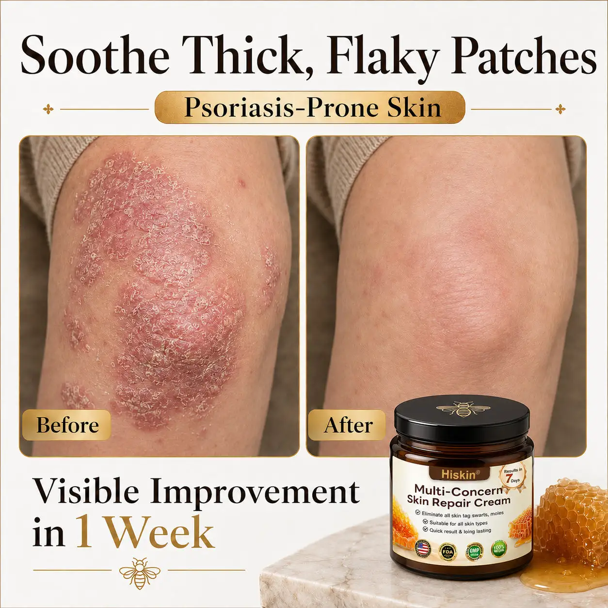 HISKIN® Multi-Concern Skin Repair Cream ✨✨ (One powerful cream to repair inflammation, dryness, aging, pigmentation, and visible skin damage.)