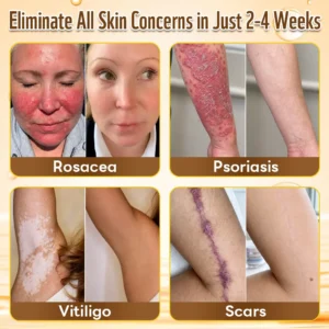 HISKIN® Multi-Concern Skin Repair Cream ✨✨ (One powerful cream to repair inflammation, dryness, aging, pigmentation, and visible skin damage.)
