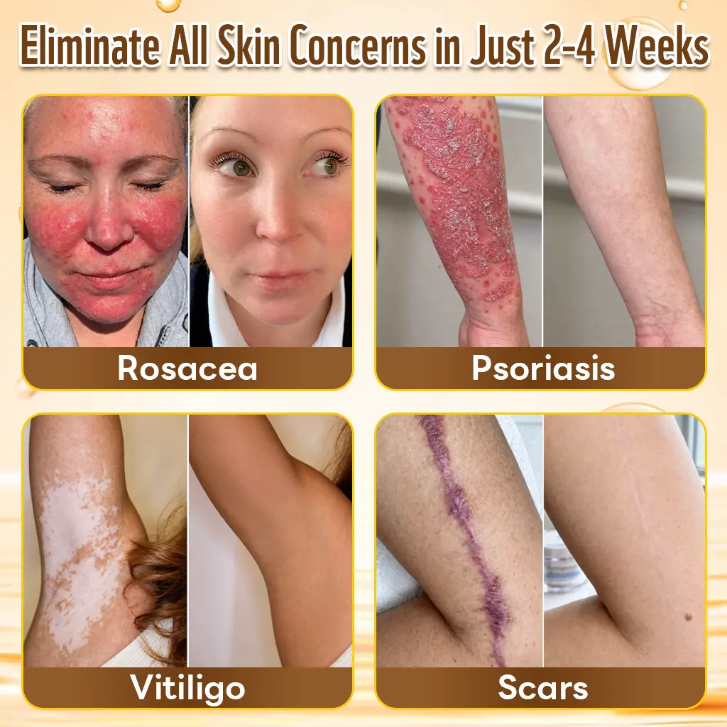 HISKIN® Multi-Concern Skin Repair Cream ✨✨ (One powerful cream to repair inflammation, dryness, aging, pigmentation, and visible skin damage.)