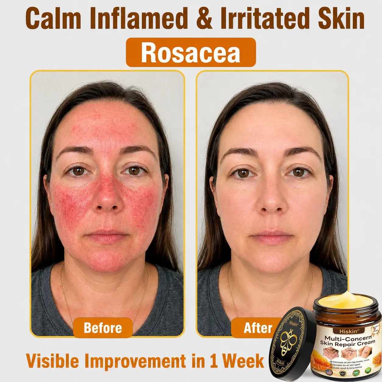 HISKIN® Multi-Concern Skin Repair Cream ✨✨ (One powerful cream to repair inflammation, dryness, aging, pigmentation, and visible skin damage.)