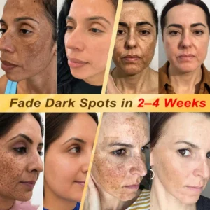 👩‍⚕️💯 𝐇𝐈𝐒𝐊𝐈𝐍® 𝟕-𝐃𝐚𝐲 𝐒𝐤𝐢𝐧 𝐓𝐚𝐠 & 𝐒𝐩𝐨𝐭 𝐄𝐫𝐚𝐬𝐞𝐫 𝐑𝐨𝐥𝐥𝐞𝐫𝐛𝐚𝐥𝐥 𝐏𝐞𝐧 🍀 | 𝐓𝐚𝐫𝐠𝐞𝐭𝐬 
 – 𝐇𝐢𝐬𝐤𝐢𝐧