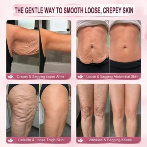 ๐๐๐๐๐๐ยฎ 7-Day Skin Transformation Body Stick Firming, Stretch Mark Smo
โ helsego