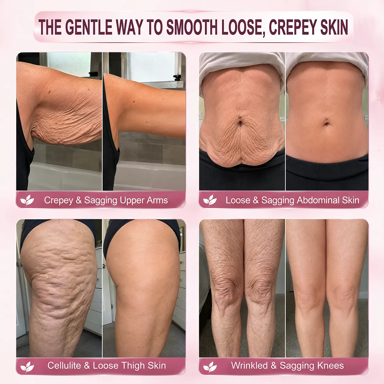 ๐๐๐๐๐๐ยฎ 7-Day Skin Transformation Body Stick Firming, Stretch Mark Smo
โ helsego