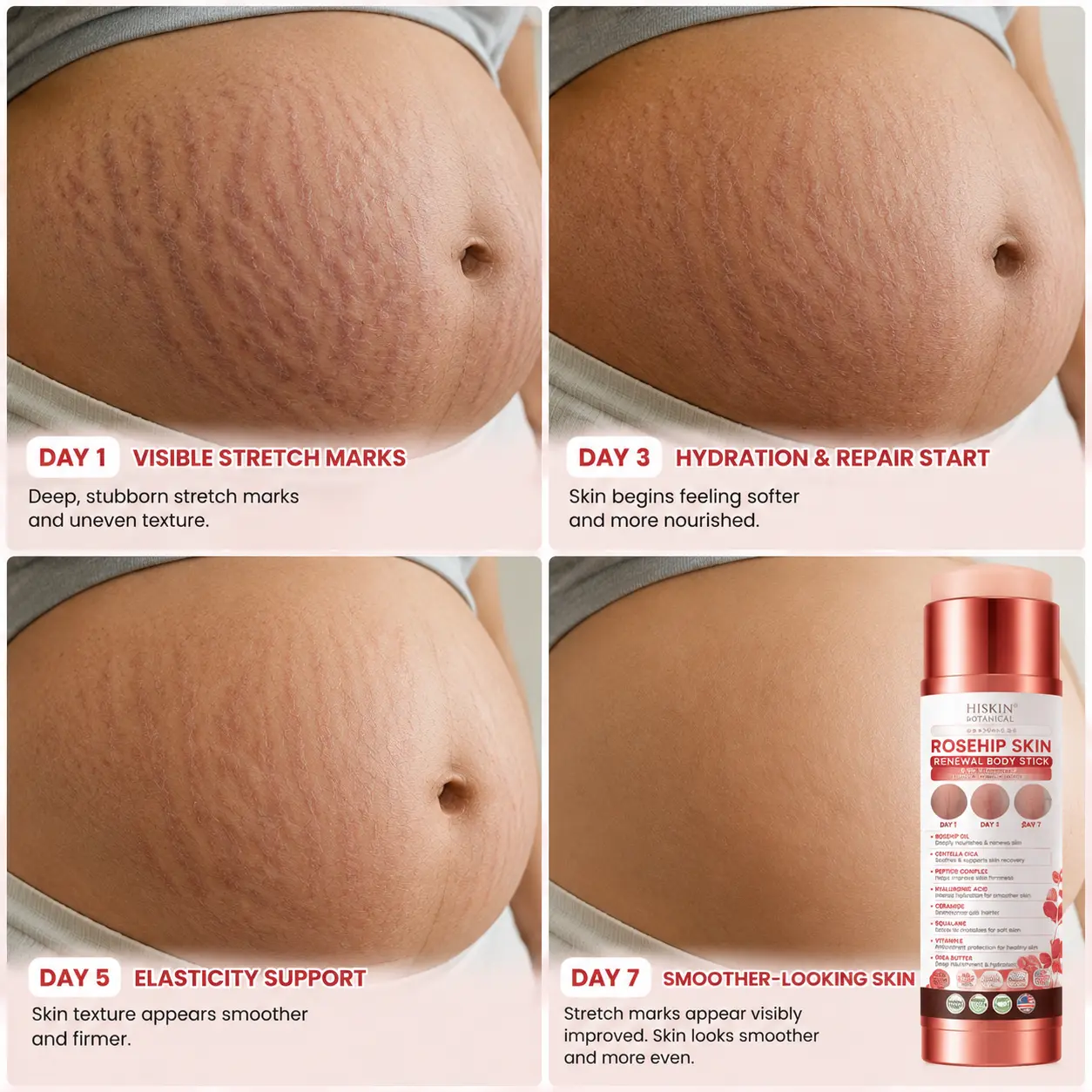 ๐๐๐๐๐๐ยฎ 7-Day Skin Transformation Body Stick Firming, Stretch Mark Smo
โ helsego