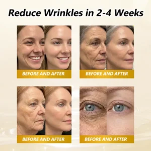 𝐇𝐈𝐒𝐊𝐈𝐍® BEE VENOM BIO-REVIVE BODY ROLLER
 – 𝐇𝐢𝐒𝐤𝐢𝐧