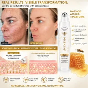 𝐇𝐈𝐒𝐊𝐈𝐍® BEE VENOM BIO-REVIVE BODY ROLLER
 – 𝐇𝐢𝐒𝐤𝐢𝐧
