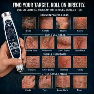 𝐇𝐈𝐒𝐊𝐈𝐍® 👩‍⚕️Calming Care for Psoriasis-Prone Skin |7-Day Soothing Roll
 –  HISKIN®  Official Store