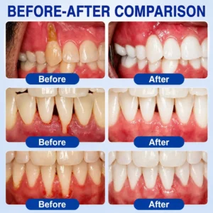 👨⚕️✅🦷 HISKIN® GumRevive Periodontal Repair Gel
– woolanddew
