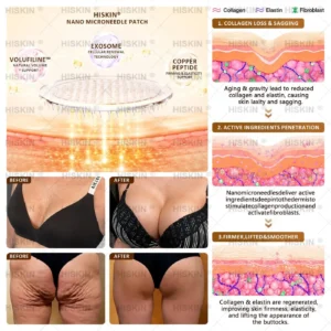 HISKIN® Bust Volume, Lift & Firming Nano Microneedle Patch Volufiline + Exosome + Copper Peptide Formula Powered by Cellular Renewal Technology