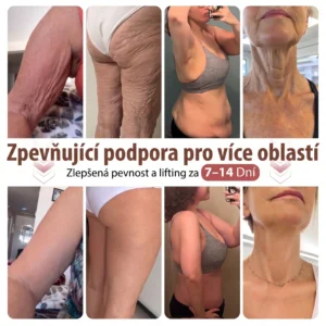 🍁HISKIN® Mikroneedlová náplast pro podporu objemu, lifting a pevnost p
– czbenubetter.com