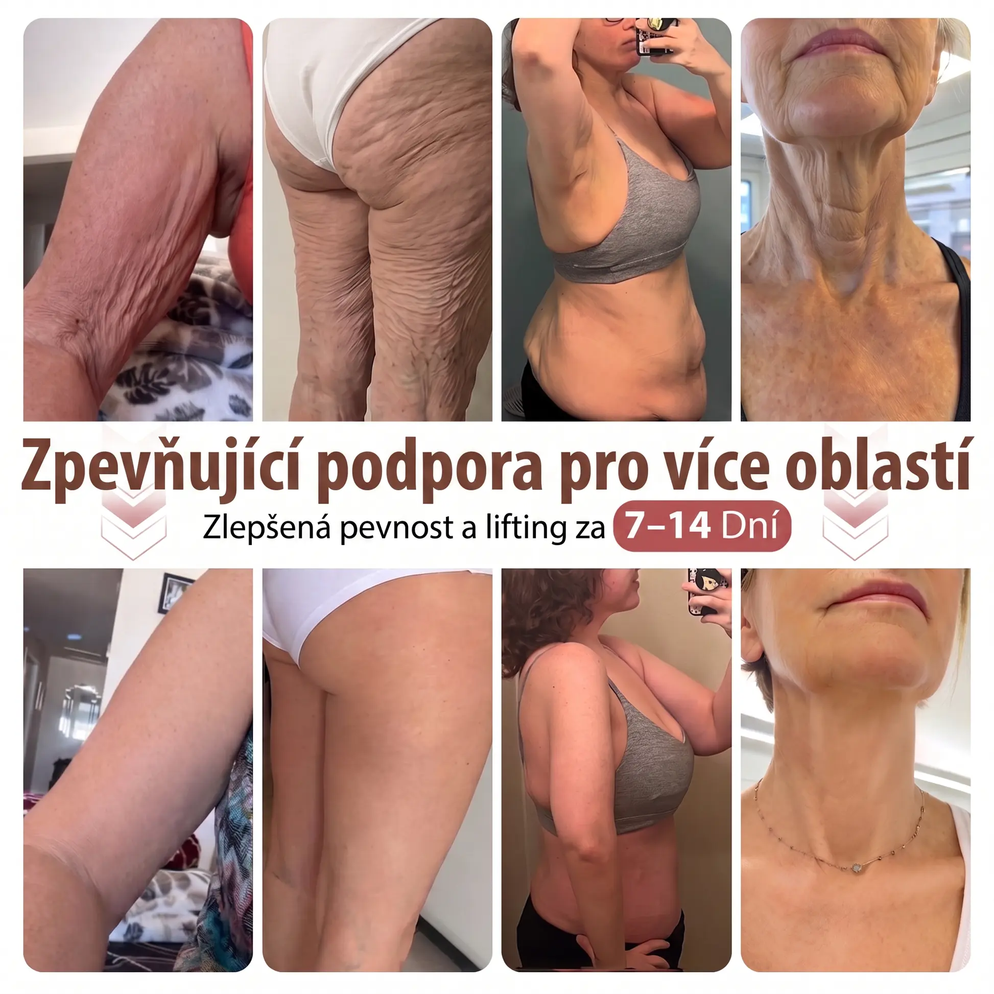 🍁HISKIN® Mikroneedlová náplast pro podporu objemu, lifting a pevnost p
– czbenubetter.com