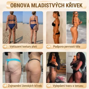 🍁HISKIN® Mikroneedlová náplast pro podporu objemu, lifting a pevnost p
– czbenubetter.com