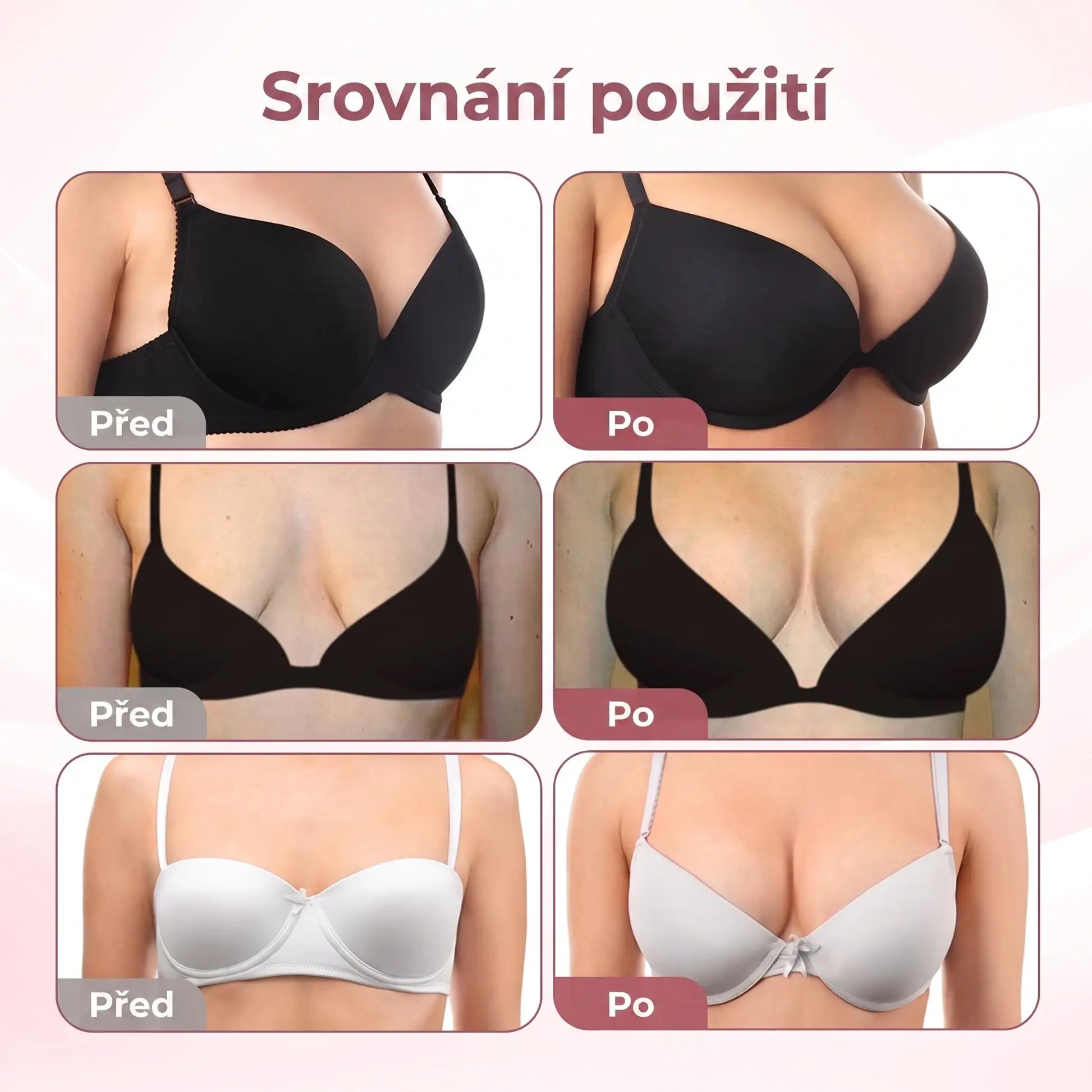 🍁HISKIN® Mikroneedlová náplast pro podporu objemu, lifting a pevnost p
– czbenubetter.com