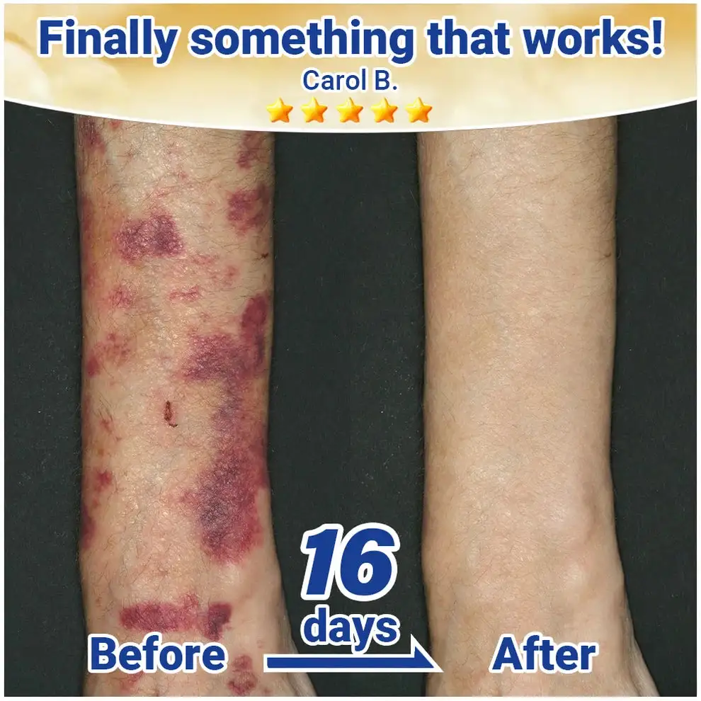 HISKIN® ResiliVeil Bruise Appearance Barrier Care Cream
– trendgre