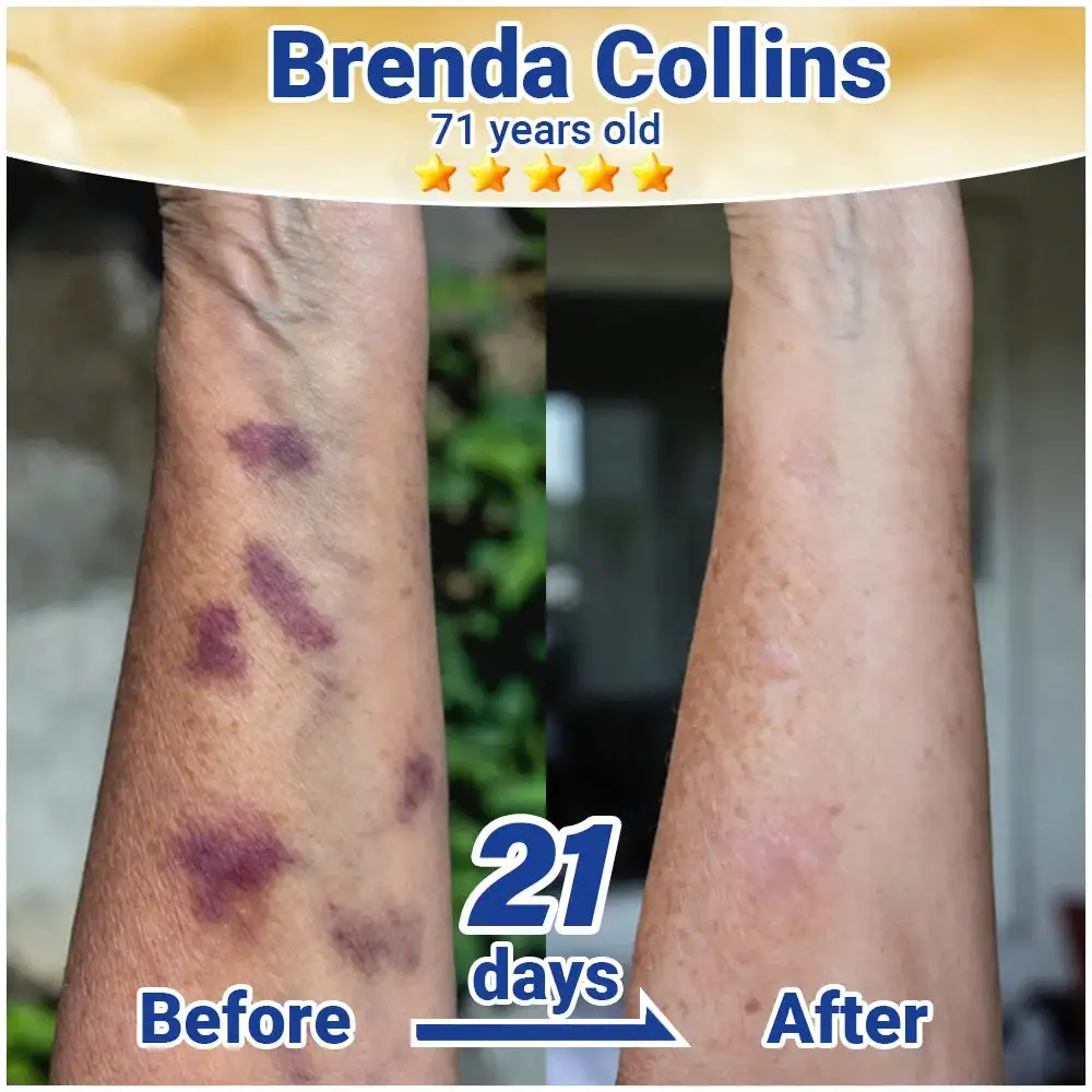 HISKIN® ResiliVeil Bruise Appearance Barrier Care Cream
– trendgre