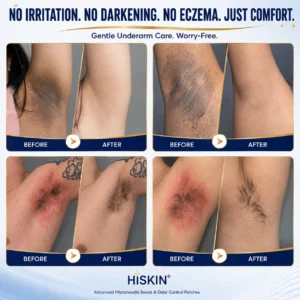 Hiskin® 2-in-1 Advanced Sweat Control & Deodorant Microneedle Patches
– HISKIN Glow